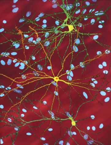 Imágenes de neuronas cultivadas en el laboratorio de Finkbeiner. Las células verdes y amarillas han sido marcadas para que brillen, mostrando la forma de las células.   