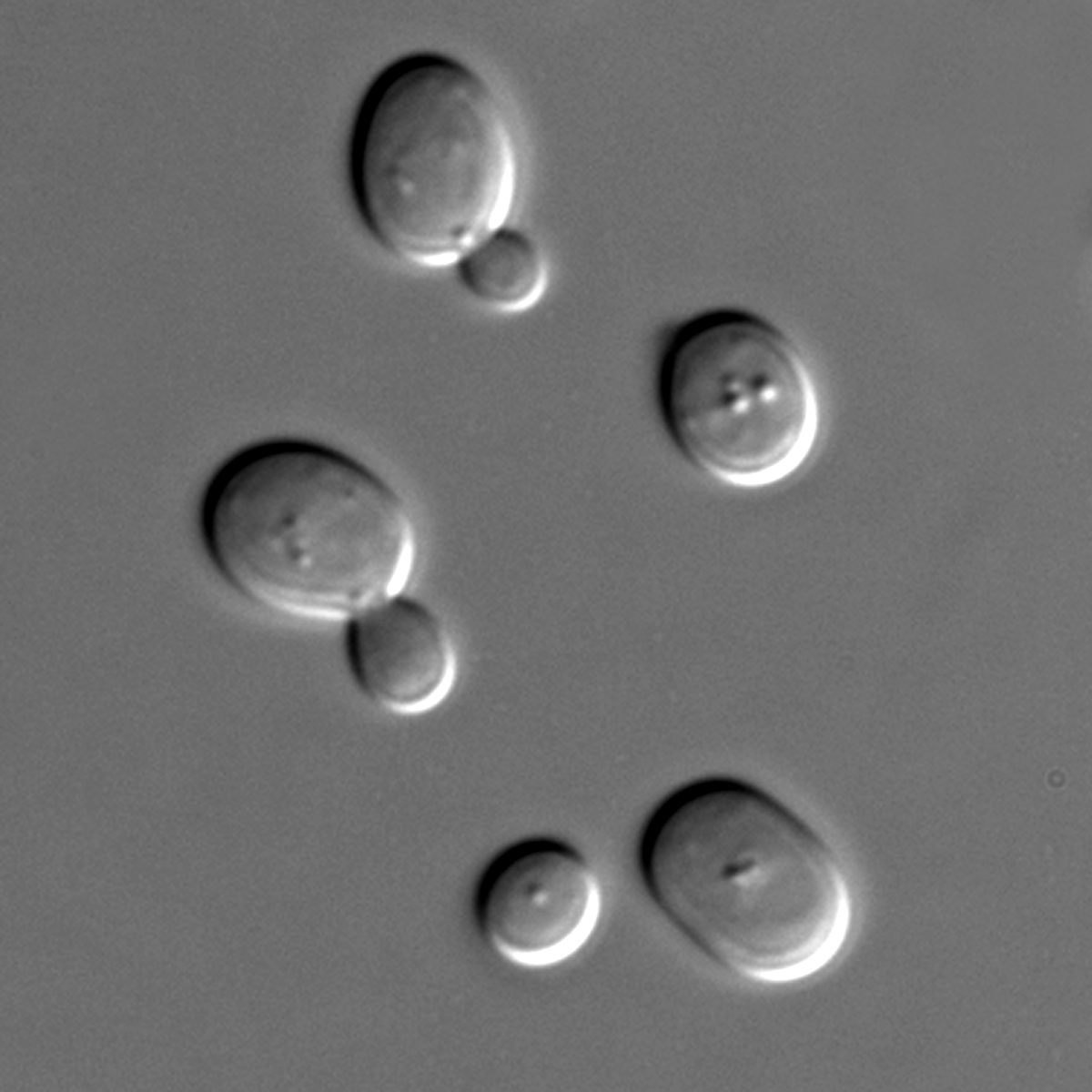 Las pequeñas células de la levadura ayudaron a Giorgini y a sus colaboradores a encontrar proteínas que protegían a las células de la proteína huntingtina mutada.  