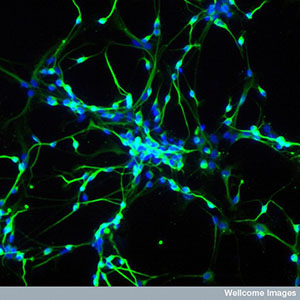 Las células madre se pueden utilizar para desarrollar neuronas en el laboratorio. Estas neuronas son herramientas muy útiles para estudiar enfermedaddes como la EH.