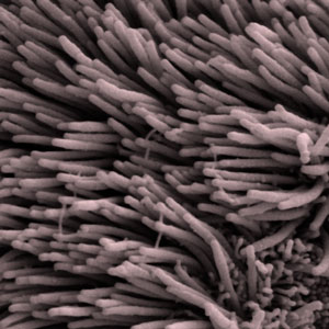Los cilios, diminutos pelos que sobresalen en los ventrículos del cerebro, ondean en sincronía para bombear el LCR. Esta función se ve alterada en el cerebro con EH, aunque todavía no está claro si esto está relacionado con los problemas "de eliminación de basura" observados en los cerebros con EH.