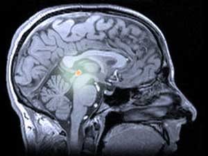 La glándula pineal, localizada en la parte profunda del cerebro, es la principal fuente de la hormona melatonina en humanos.