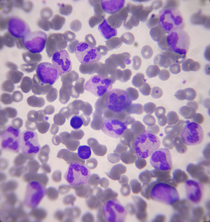 Los glóbulos blancos se encargan de la defensa del cuerpo contra gérmenes invasores
