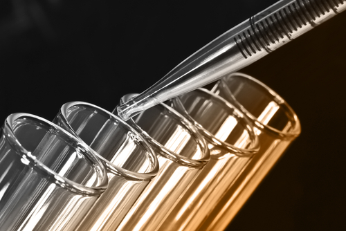 El seguimiento de un grupo de metabolitos clave en la sangre durante un período de 24 horas podría predecir el estado de una enfermedad del ganado ovino.