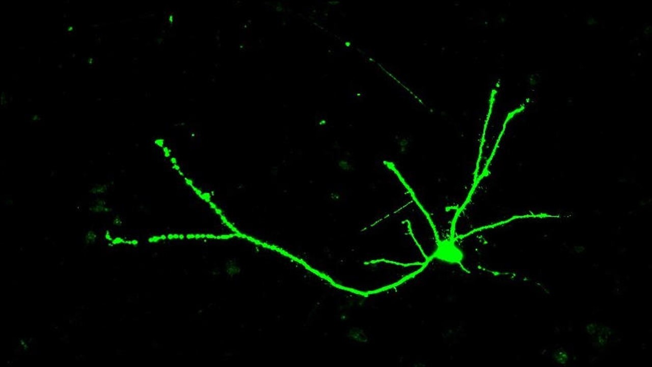 Las células nerviosas tienen forma de árboles, con un cuerpo celular que contiene muchas ramas en la parte superior de la célula nerviosa, un tronco largo y un sistema de "raíces" ramificadas en la parte inferior de la célula.