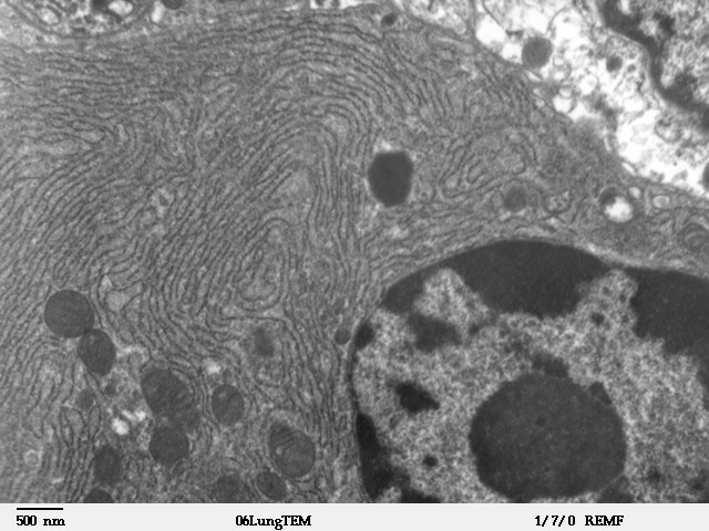 Las líneas onduladas de esta imagen son el "retículo endoplásmico" de una célula - los depósitos donde se almacena el calcio. Los receptores de rianodina se encuentran en estas estructuras.  