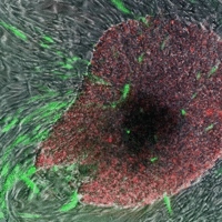 'Células madre pluripotenciales inducidas' en verde y en rojo, brillando por encima de las células de la piel que las rodean  