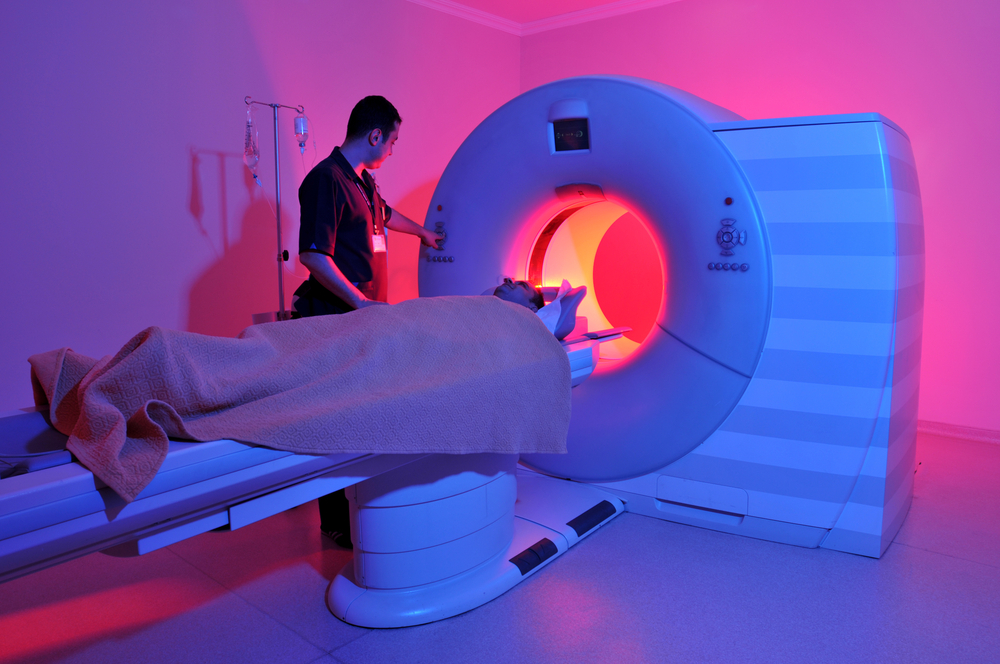 La cuidadosa medición de los surcos cerebrales, utilizando resonancia magnética, fue una de la forma más importante de medir la progresión de la enfermedad de Huntington según el estudio TRACK-HD.  
