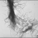 Conocer al enemigo: Los haces de neutrones muestran la estructura de la proteína de la EH