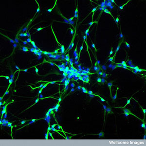 Las células madre se pueden utilizar para desarrollar neuronas en el laboratorio. Estas neuronas son herramientas muy útiles para estudiar enfermedaddes como la EH.  